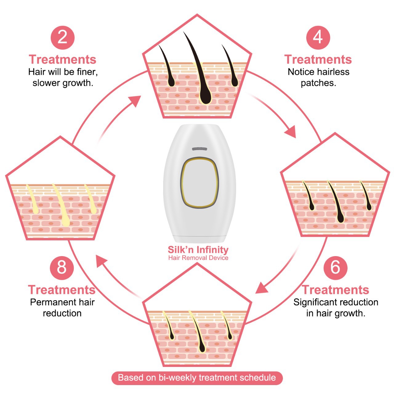 IPL Hair Removal Device